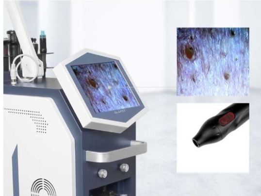Skin Analysis Machine